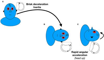 Management of Lateral Semicircular Canal Benign Paroxysmal Positional Vertigo